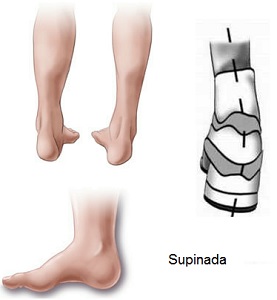 tenis masculino supinado